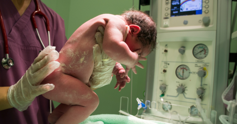 Gastroshiza: A Serious Yet Treatable Condition